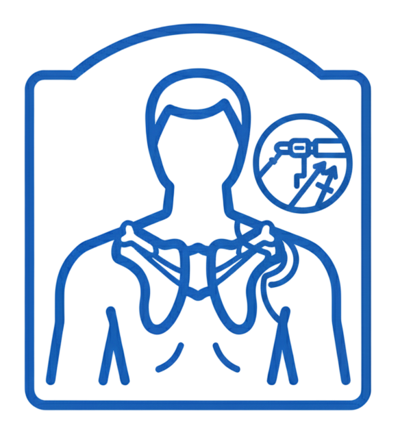 Kapsülolabral Rekonstrüksiyon