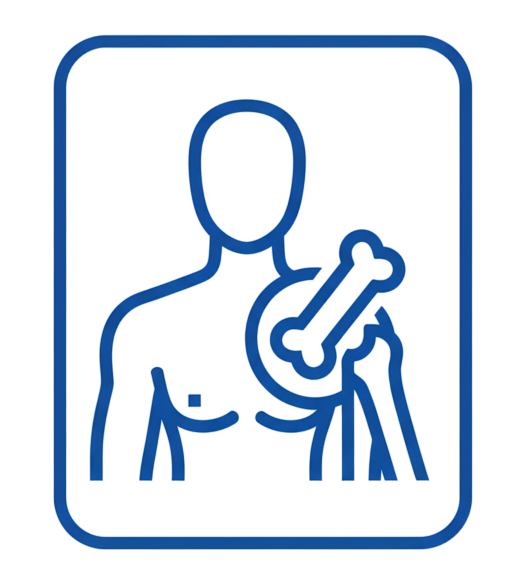 Akromiyoklaviküler (AC)